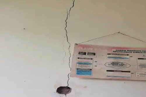 El sismo de 7.7 de magnitud que se registró el último viernes en la región Loreto, afectó la   estructura física de varios establecimientos de salud en la región San Martín, los cuales deberán ser rehabilitados posteriormente para evitar accidentes, indica el informe del director de la Red de Salud de la provincia Lamas, Abigael Angulo Vásquez.