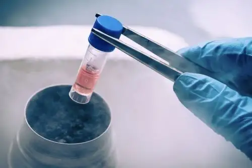 Criopreservación de óvulos: técnica para conservar la fertilidad