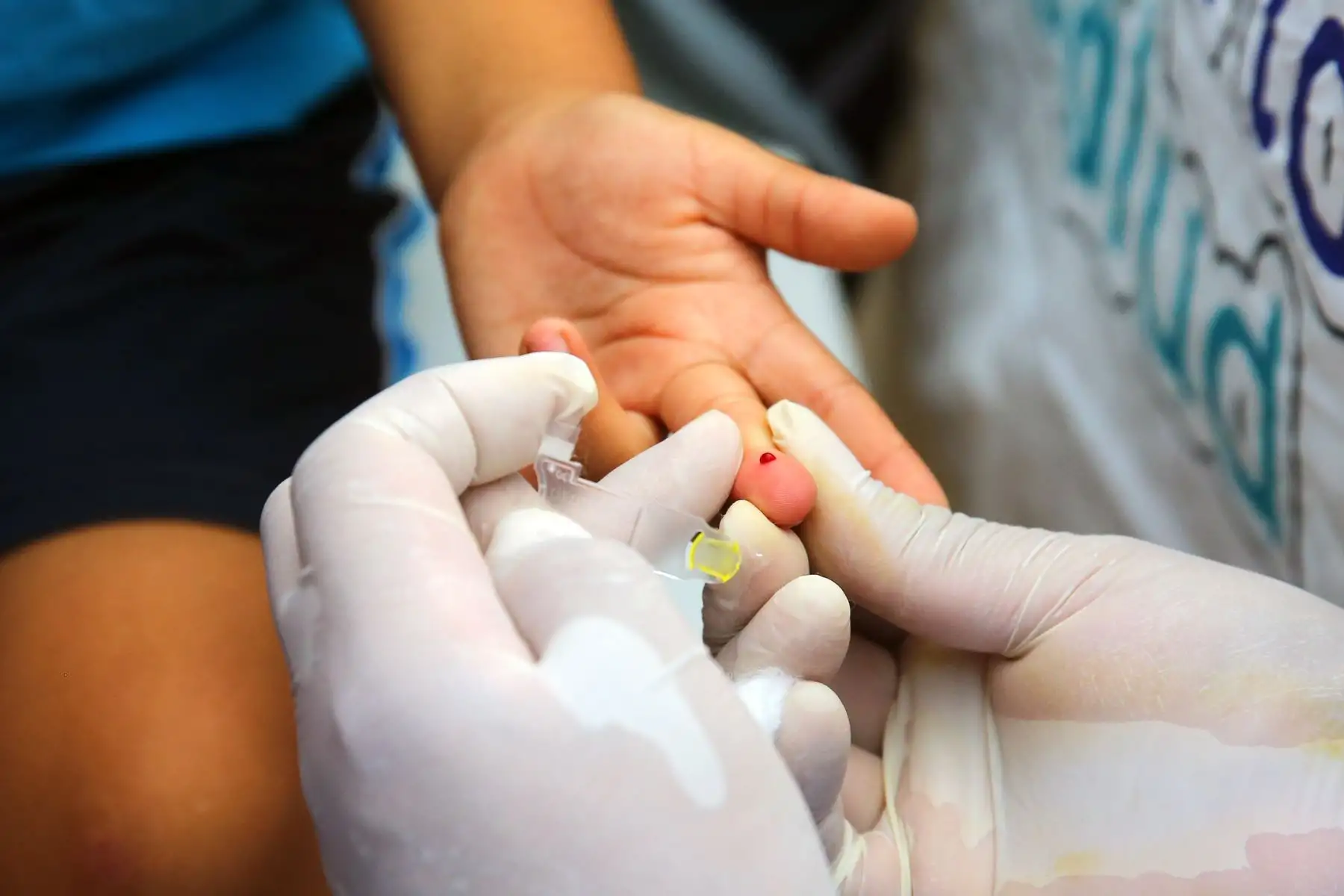 Gran Cruzada contra la Anemia en el país con el objetivo de proteger contra esta enfermedad a los niños menores de tres años de edad y a las gestantes. en San Juan de Lurigancho. Foto: ANDINA/Vidal Tarqui
