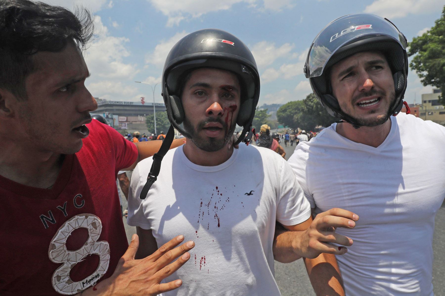 Manifestantes heridos durante una manifestación en apoyo al presidente interino, Juan Guaidó. Foto: EFE