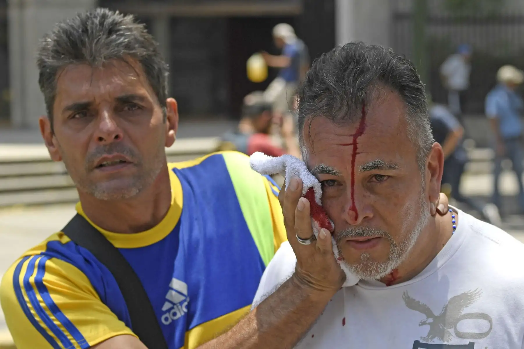Manifestantes heridos durante una manifestación en apoyo al presidente interino, Juan Guaidó. Foto: EFE