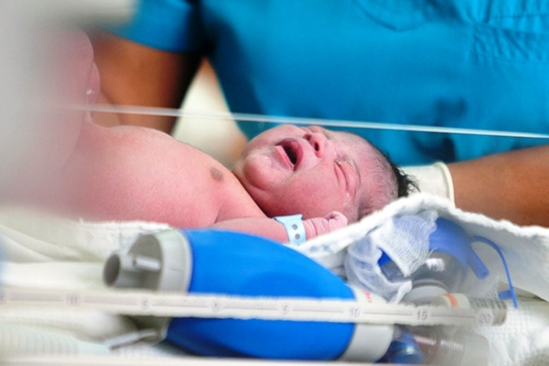Minsa: parto por cesárea incrementa posibilidad de tener bebés con anemia. Foto: ANDINA/Difusión.
