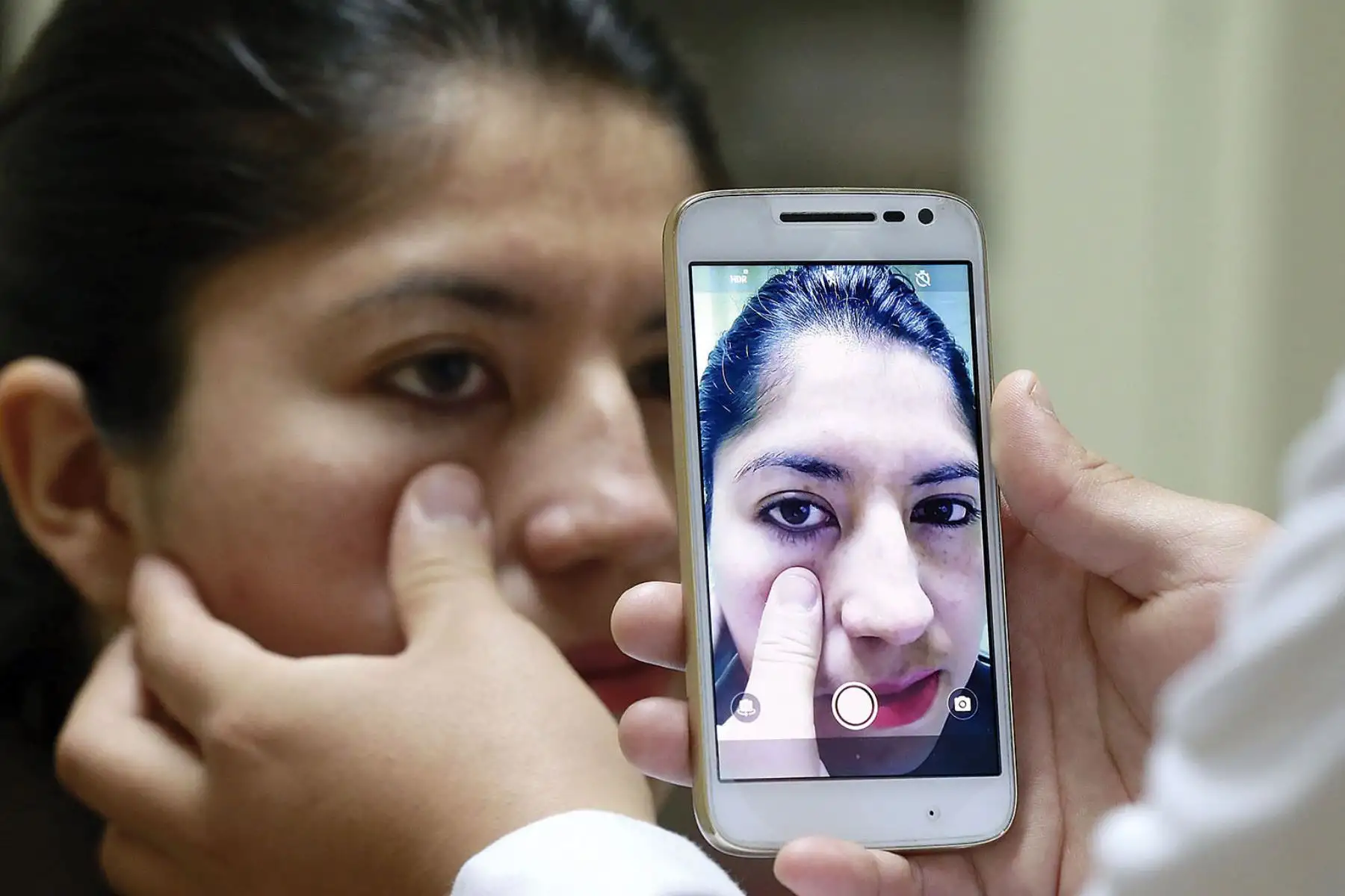 En evaluación reciente se pudo demostrar que método sirve para detectar anemia moderada y severa. Foto: Andina