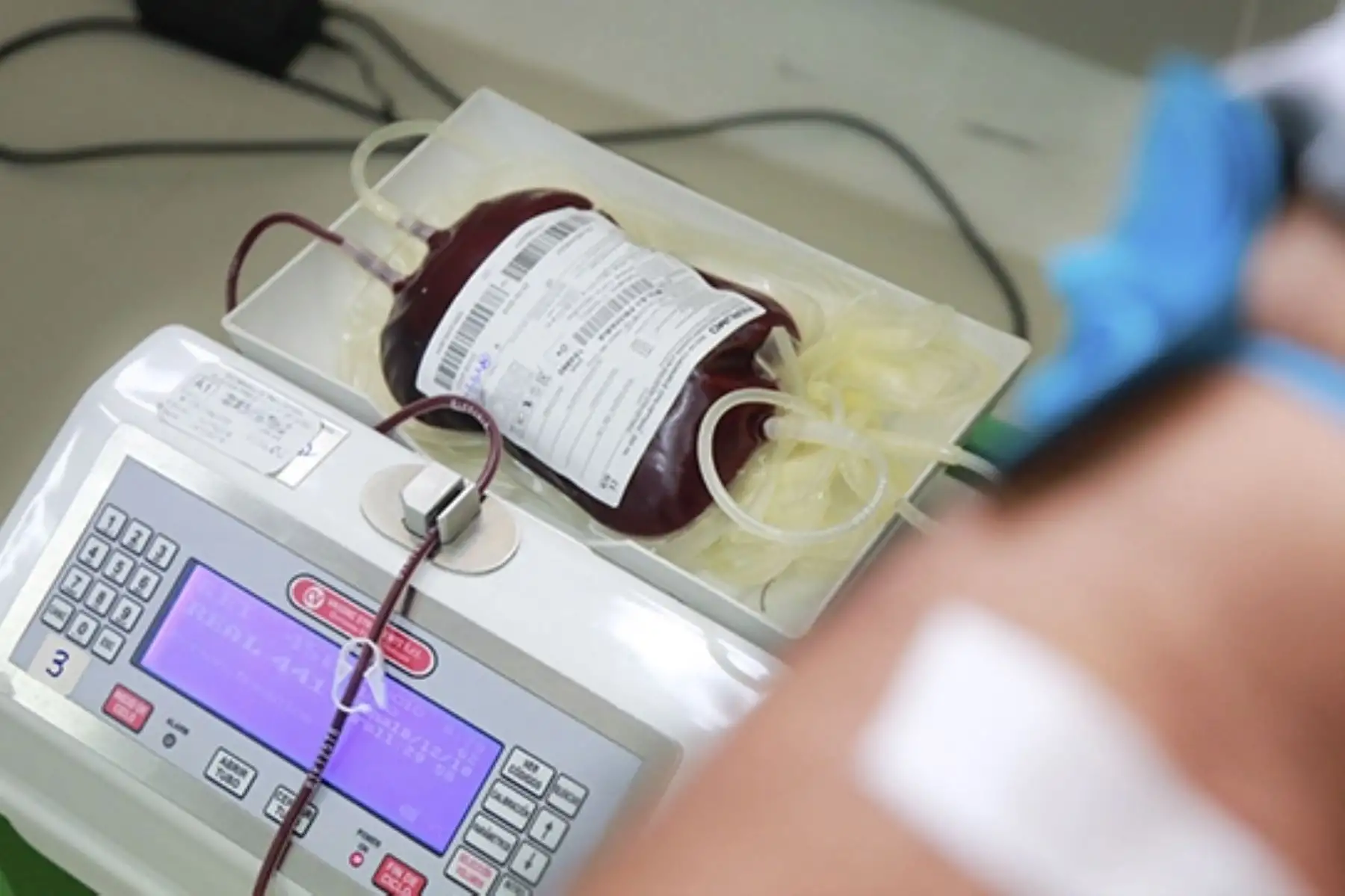 Guillain Barré: conoce el tratamiento médico para este síndrome que es gratuito. ANDINA/archivo