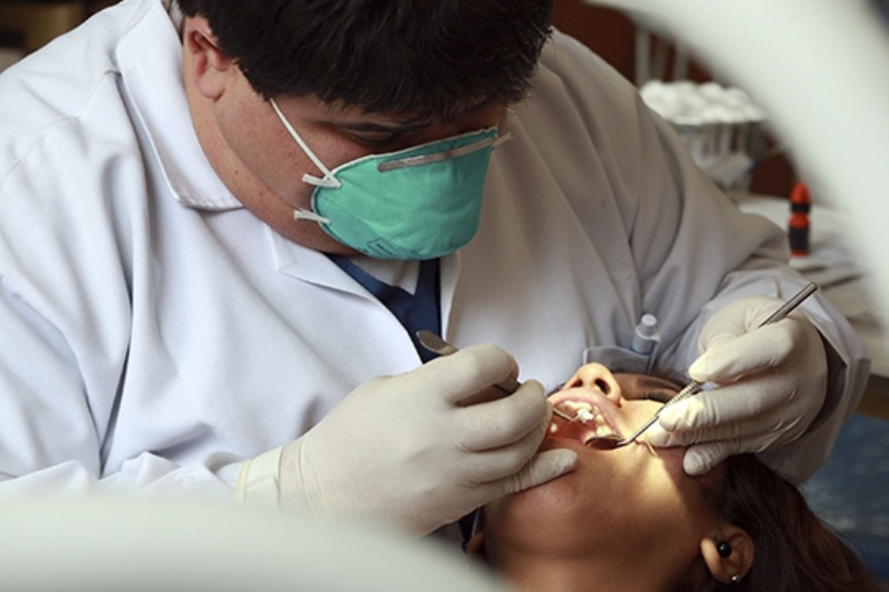El 90.4% de los peruanos tiene caries dental, revelan dentistas. Foto: ANDINA/Minsa.