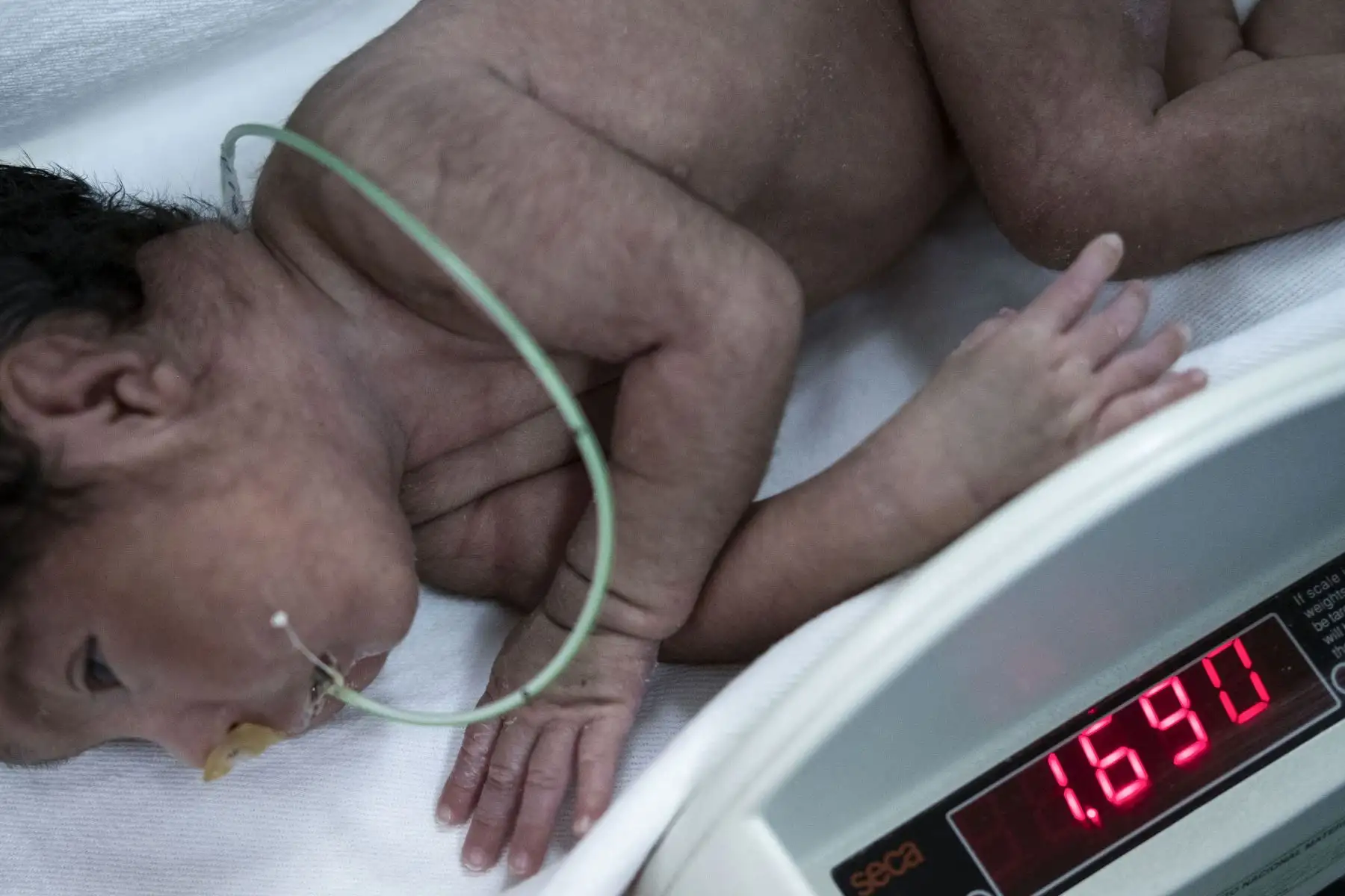 Un bebé sano es pesado en el Instituto Nacional Materno Perinatal. La función principal de la leche materna es el factor inmunológico. A diferencia de las fórmulas que venden en las farmacias, la leche materna contiene factores bioactivos como macrófagos, probióticos y prebióticos que crearán defensas en los seres humanos para toda su vida. 
Foto: ANDINA/Miguel Mejía Castro