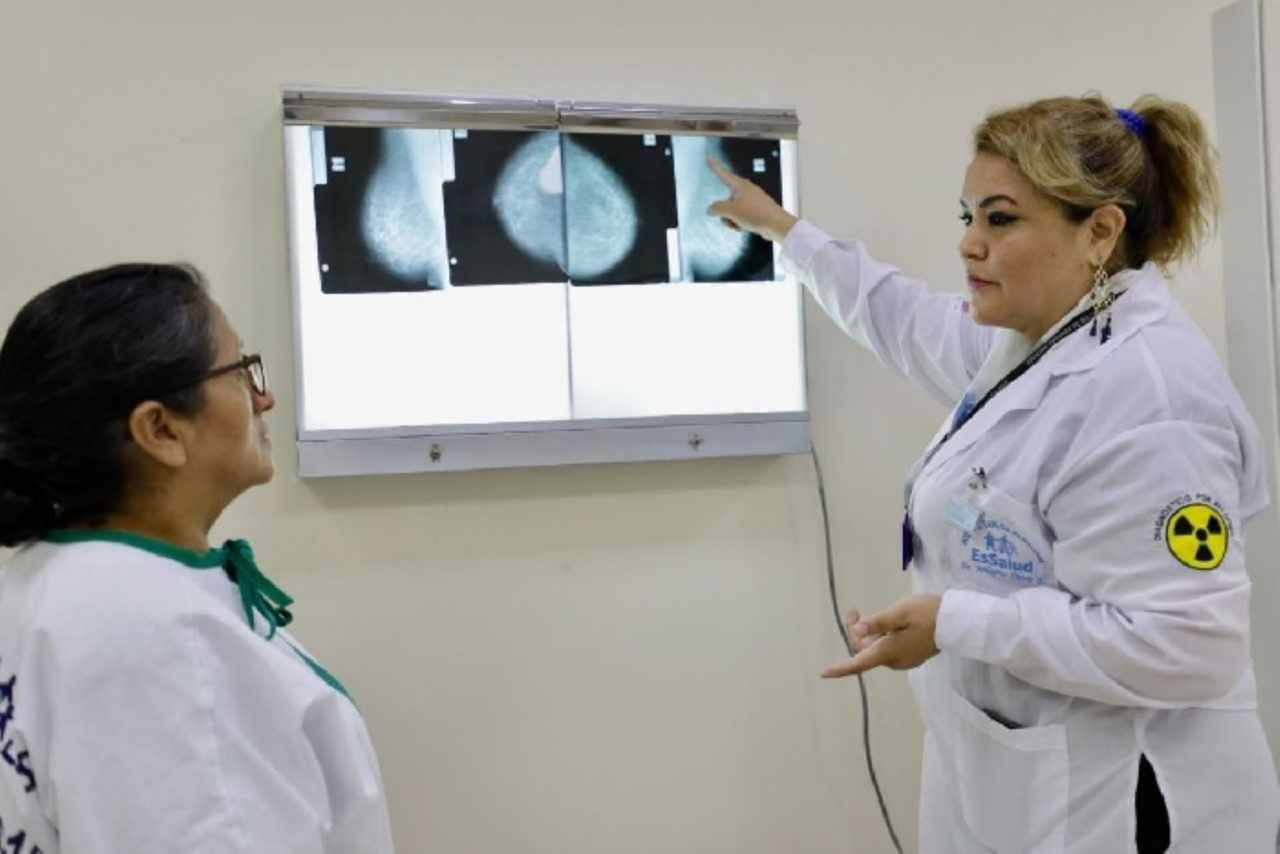 Una técnica para la detección precoz de cáncer de mama, aplican especialistas de la Red Asistencial Cusco del Seguro Social de Salud (EsSalud), lo que permite dar un tratamiento oportuno a las pacientes que padecen esta enfermedad, el más frecuente diagnosticado en mujeres.