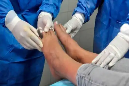 La Red Asistencial La Libertad de EsSalud implementó en el Hospital Víctor Lazarte la Unidad Avanzada de Pie Diabético. para brindar atención especializada a los pacientes que presentan esta patología, la cual suele conducir a severas amputaciones cuando no es tratada oportunamente.