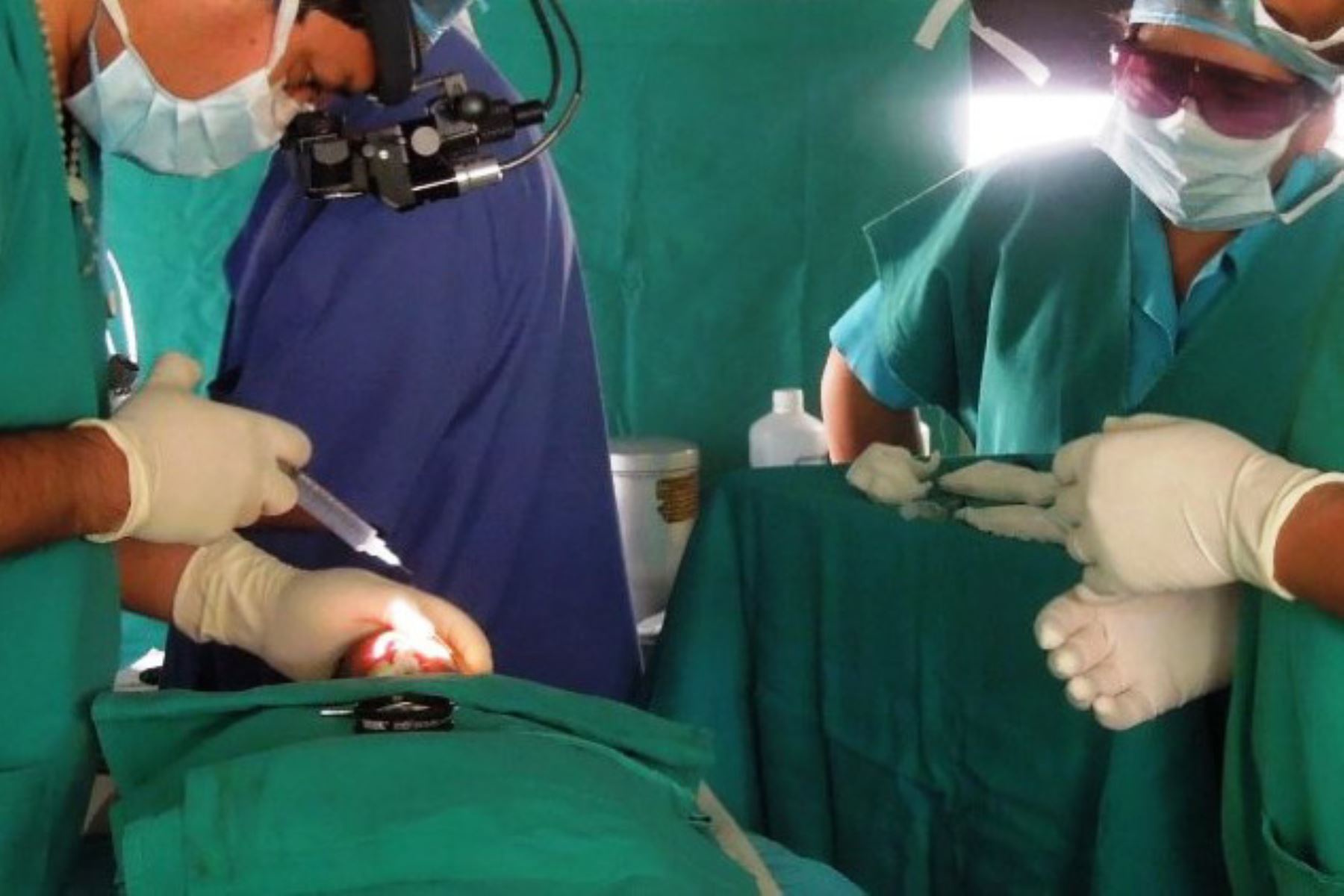 Dos hospitales de Cusco realizan cirugía conjunta y evitan ceguera a bebé prematuro.