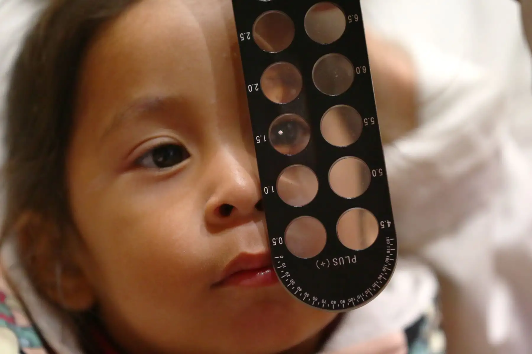 Instituto de Salud del Niño San Borja realiza campaña oftalmológica. Foto: ANDINA/Melina Mejía