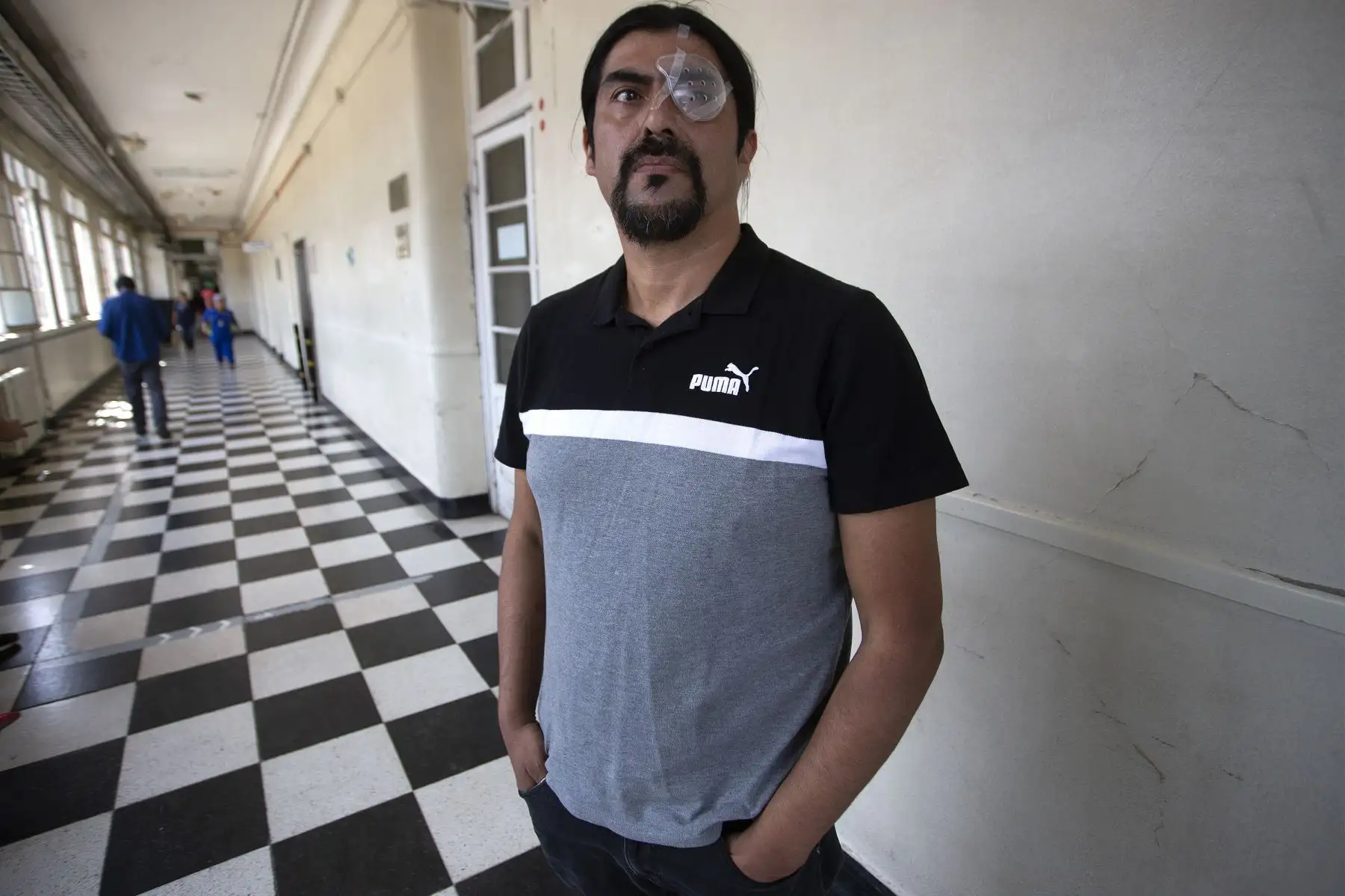 El trabajador de la construcción chileno Nelson Iturriaga, de 43 años, resultó herido en el ojo debido a la violencia policial mientras protestaba, posa en un hospital de Santiago.
Foto: AFP
