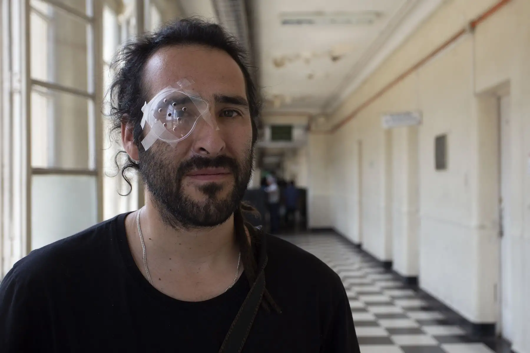El trabajador de construcción y músico chileno César Callozo, de 35 años, resultó herido en el ojo debido a la violencia policial mientras protestaba, posa en un hospital de Santiago.
Foto: AFP