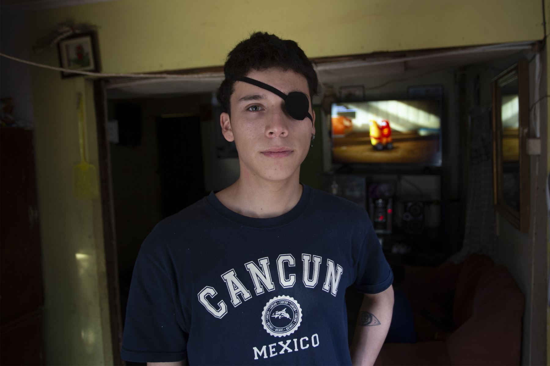 El estudiante chileno Carlos Vivanco, de 18 años, que resultó herido en el ojo debido a la violencia policial mientras protestaba, posa para una foto en su casa en Santiago. 
Foto: AFP