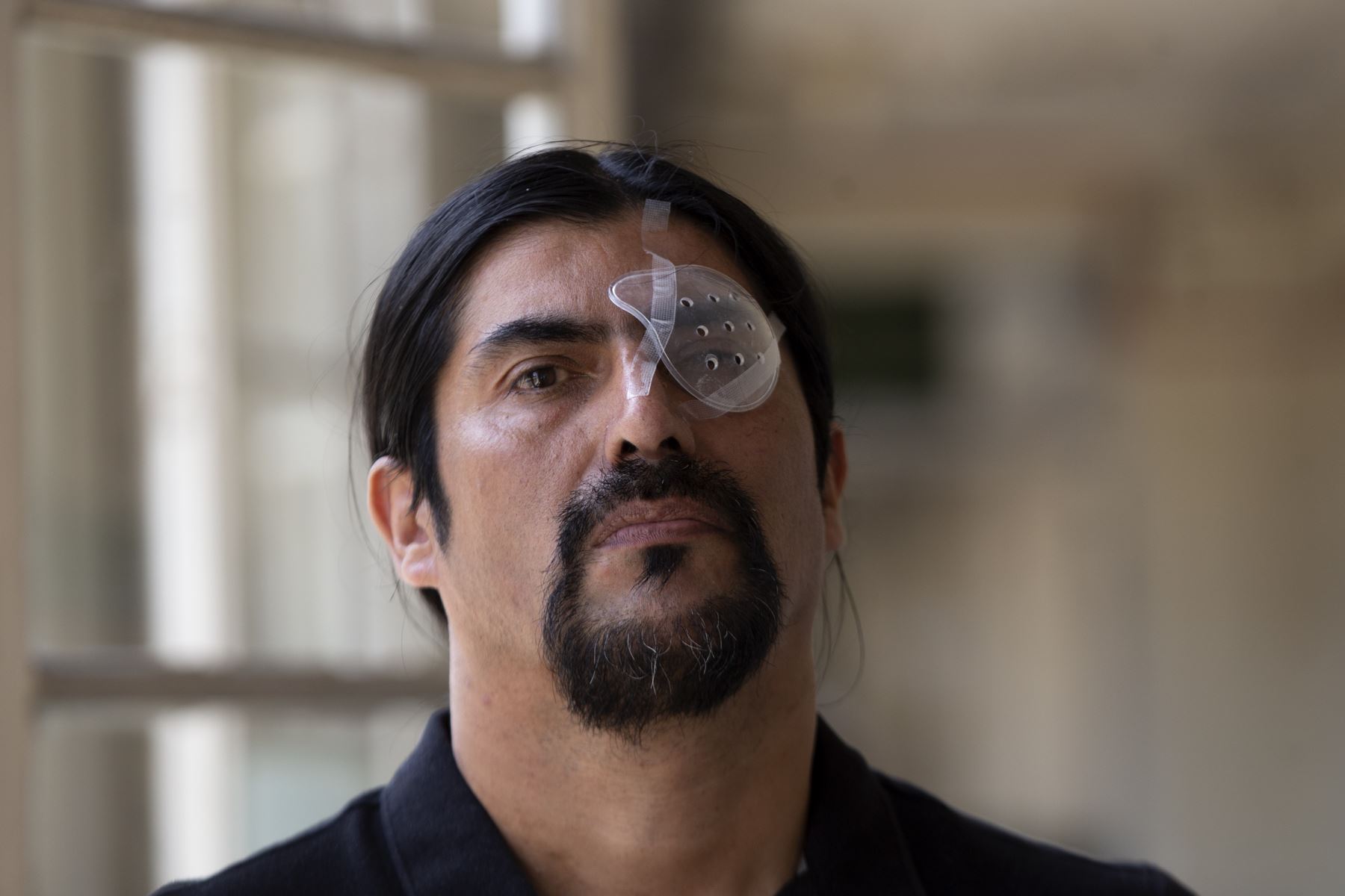 El trabajador de construcción chileno Nelson Iturriaga, de 43 años, resultó herido en el ojo debido a la violencia policial mientras protestaba, posa en un hospital de Santiago.
Foto: AFP