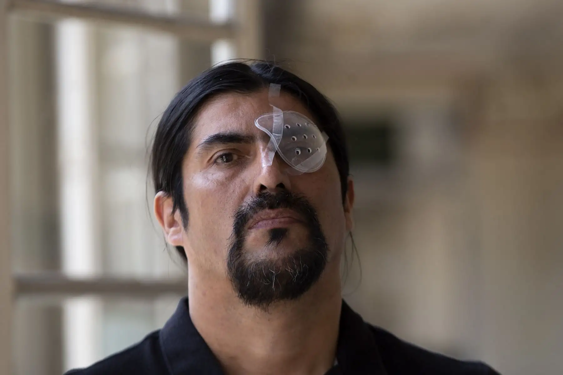 El trabajador de construcción chileno Nelson Iturriaga, de 43 años, resultó herido en el ojo debido a la violencia policial mientras protestaba, posa en un hospital de Santiago.
Foto: AFP