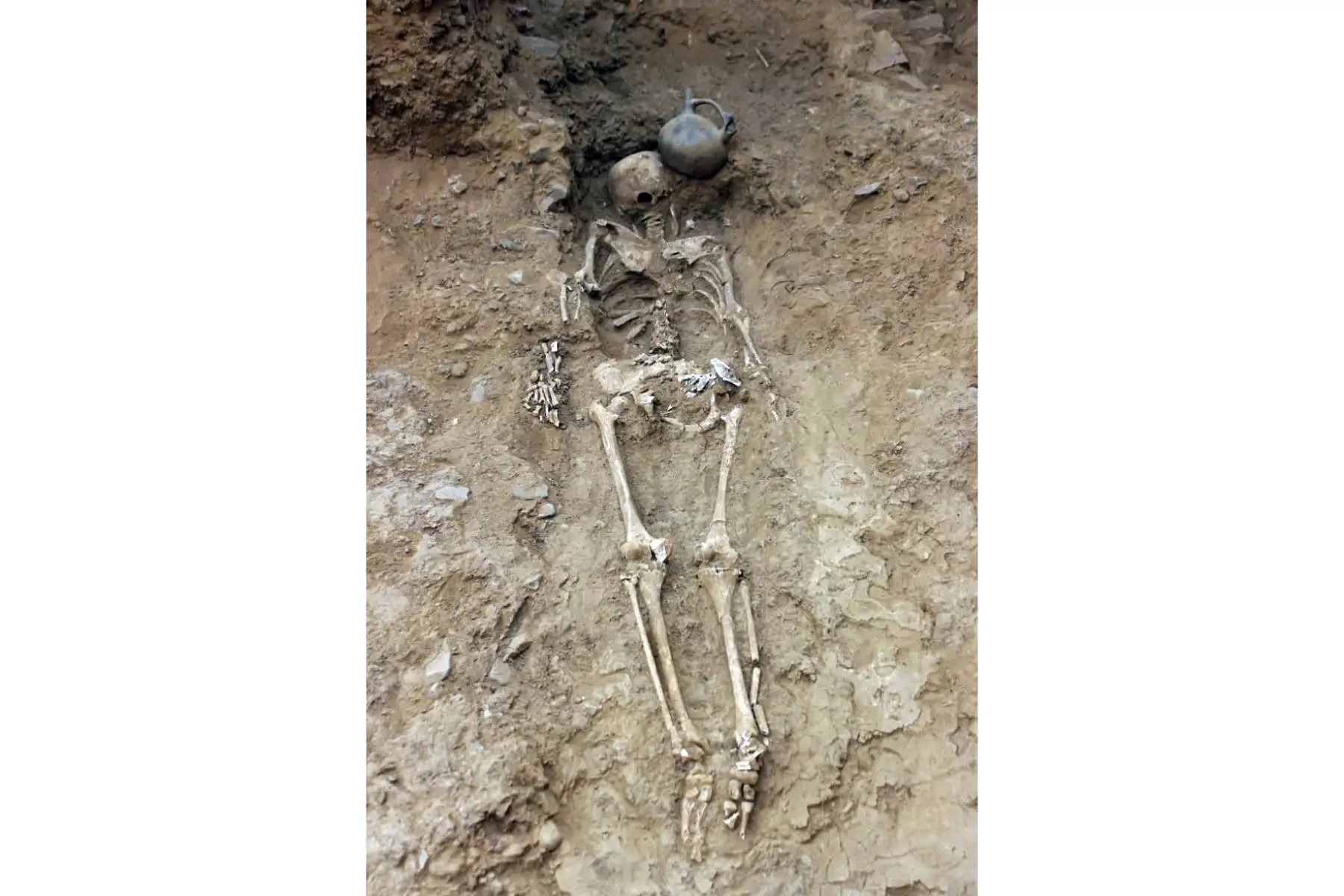 Restos humanos en el sitio de excavación de El Toro, donde se desenterró un templo megalítico de 3.000 años de antigüedad, en Oyotun, provincia de Chiclayo, departamento de Labayeque, Perú.
El templo supuestamente se utilizó para organizar rituales paganos de culto al agua en el antiguo Perú.
Foto: AFP