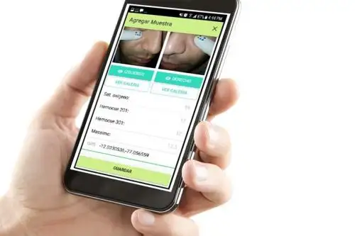 El algoritmo de inteligencia artificial analizará las imágenes de la conjuntiva de los ojos de los pacientes. Foto: Andina