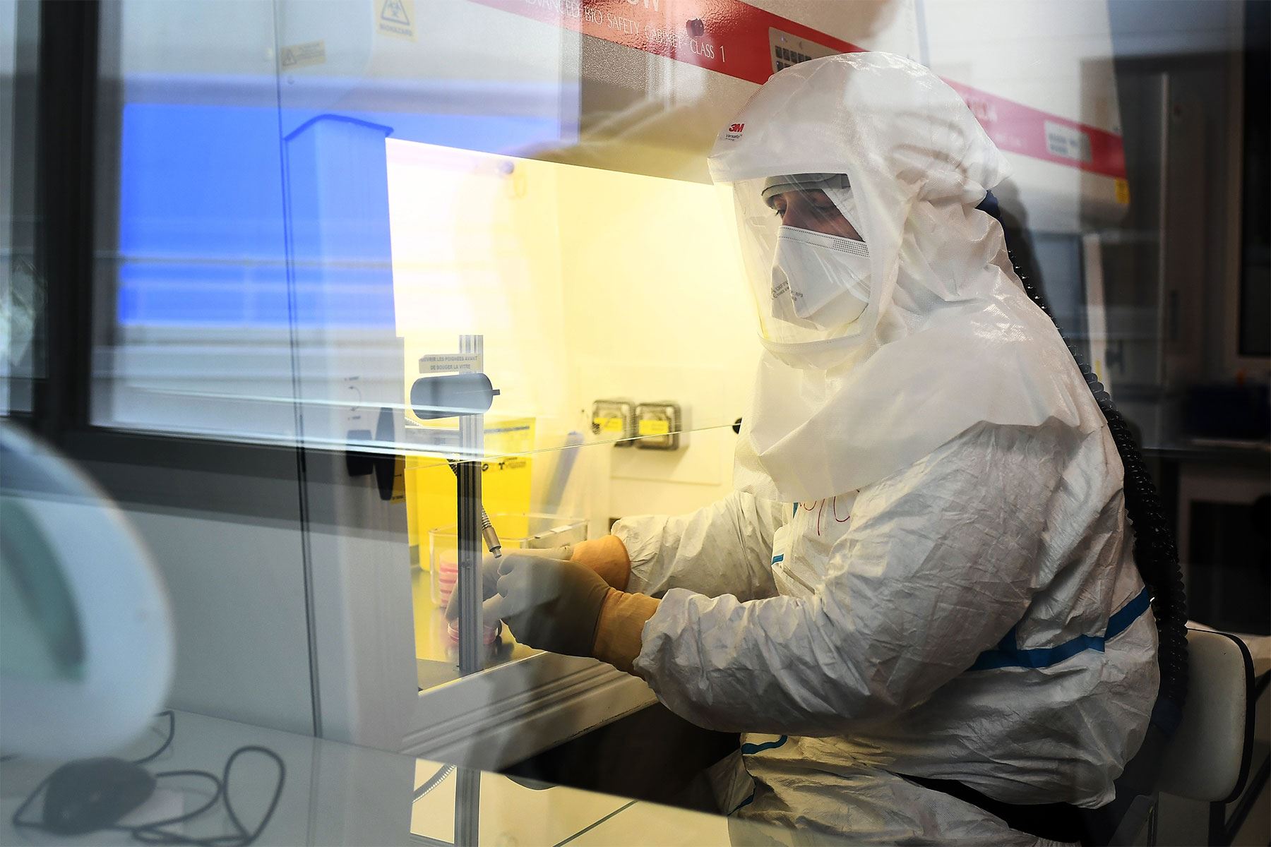Investigadores buscan mejorar la efectividad de la vacuna contra la tuberculosis. Foto: AFP.