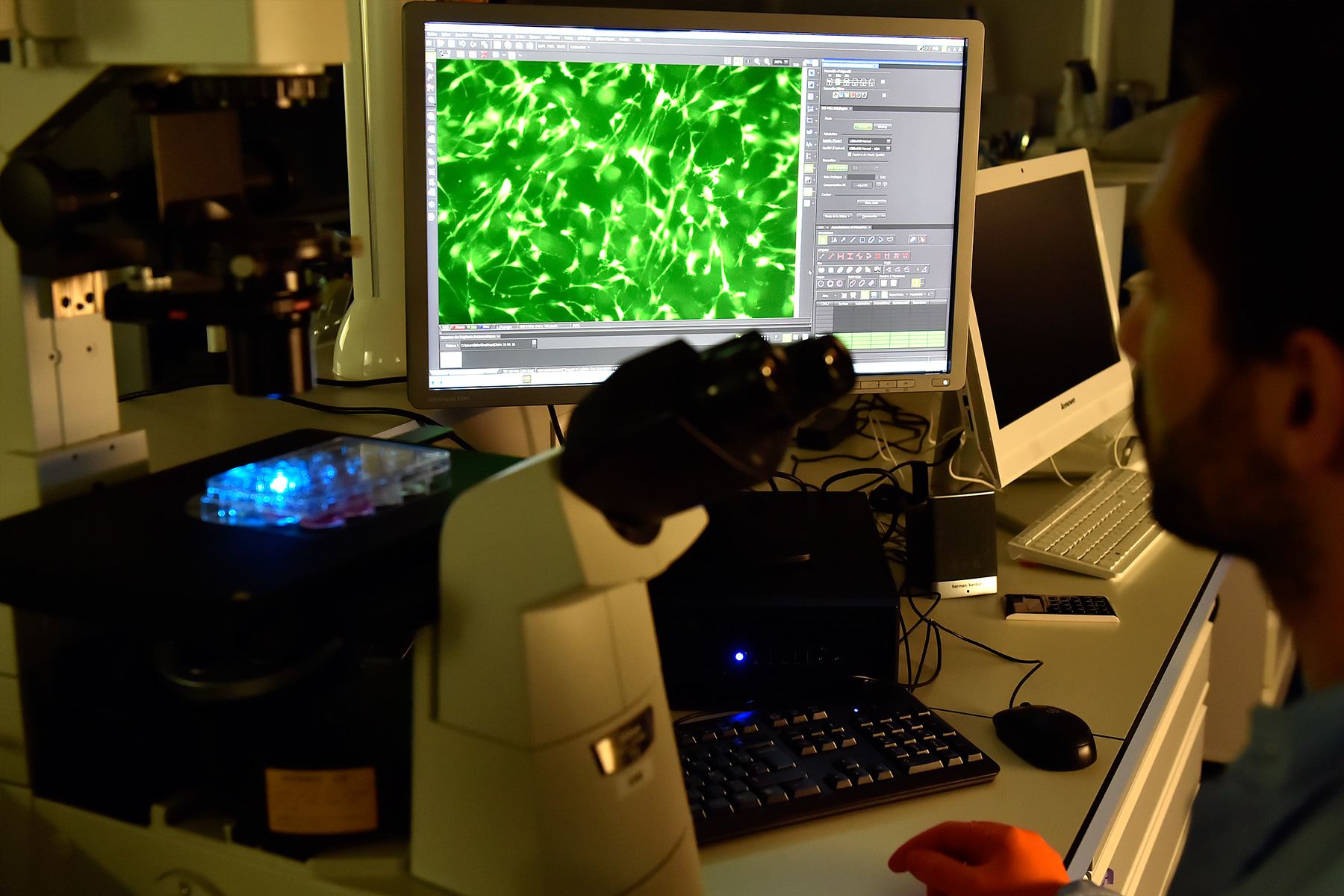 Biólogos computacionales desarrollaron herramienta para estudiar la comunicación entre células, que puede usarse para estudiar tumores. Foto: AFP.