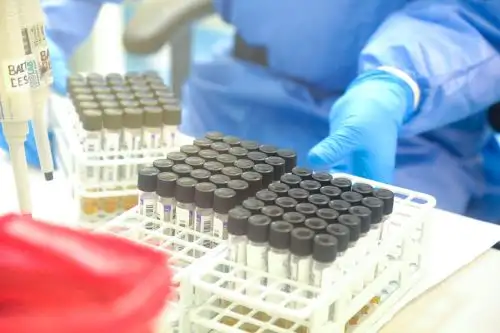 Confirman el segundo caso positivo de coronavirus en La Libertad. ANDINA/Difusión