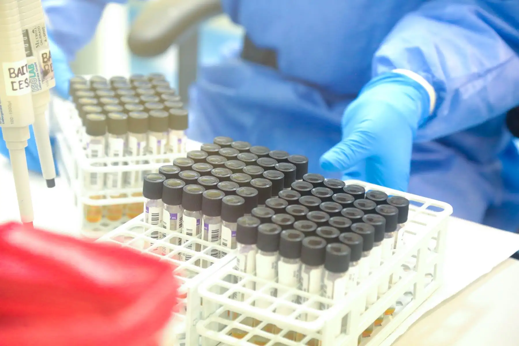 Confirman el segundo caso positivo de coronavirus en La Libertad. ANDINA/Difusión