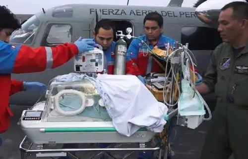 Seguro Integral de Salud (SIS) financió la atención especializada a cerca de cuatro mil niños que nacieron con este problema congénito durante 2019.