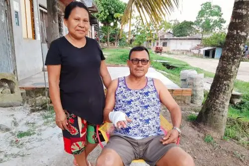 Foto: ANDINA/DifusiónProeza médica en Loreto, especialistas salvan vida de obrero que sufrió graves quemaduras. ANDINA/Difusión