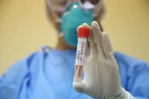 La región del Cusco contará, desde este lunes, con el primer laboratorio descentralizado de análisis de casos sospechosos de coronavirus Covid-19, que implementará el Ministerio de Salud para optimizar la detección oportuna de esta enfermedad, anunció el gobernador Jean Paul Benavente García. ANDINA/Jhonel Rodríguez Robles