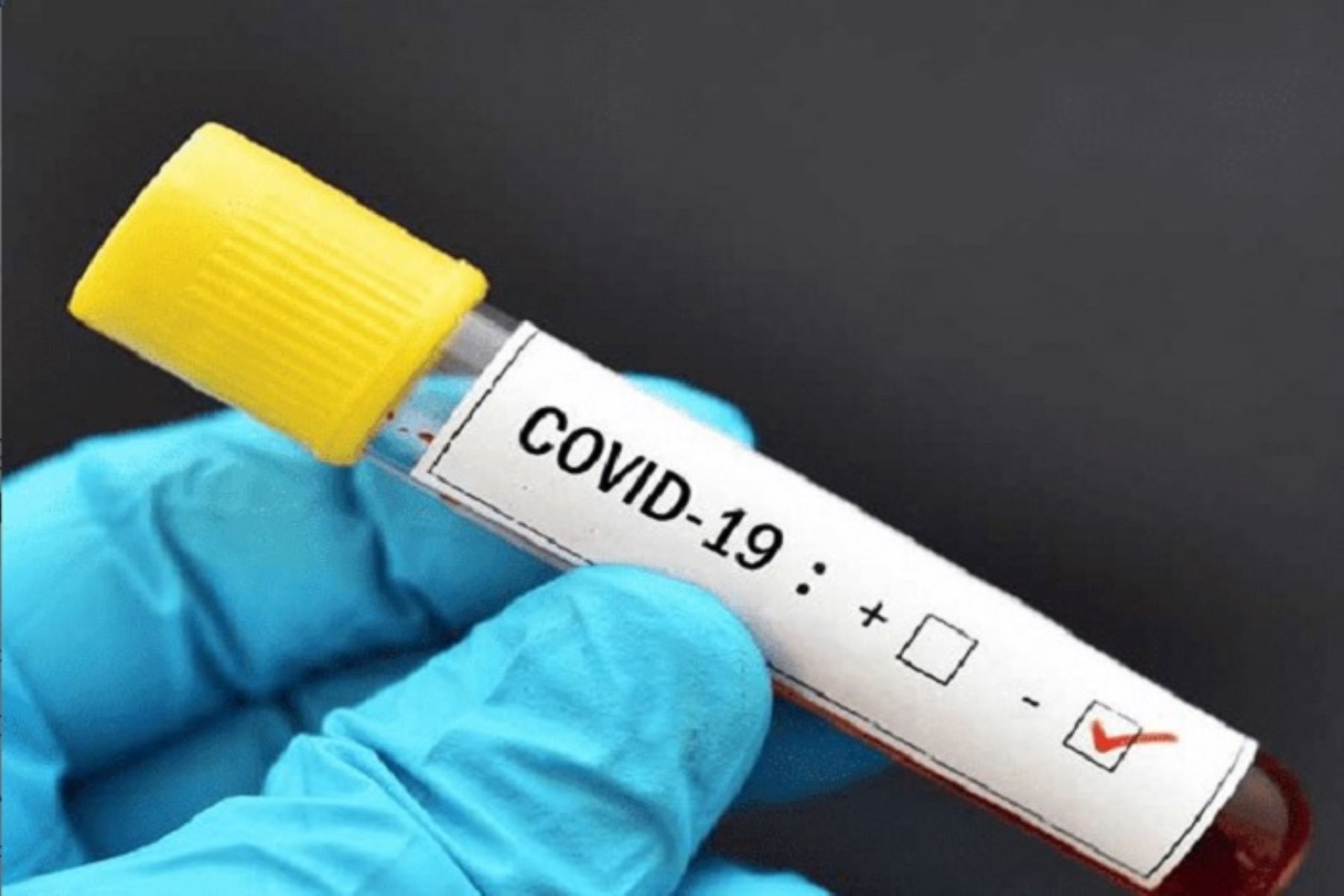 Descartan caso sospechoso de coronavirus en provincia limeña de Barranca