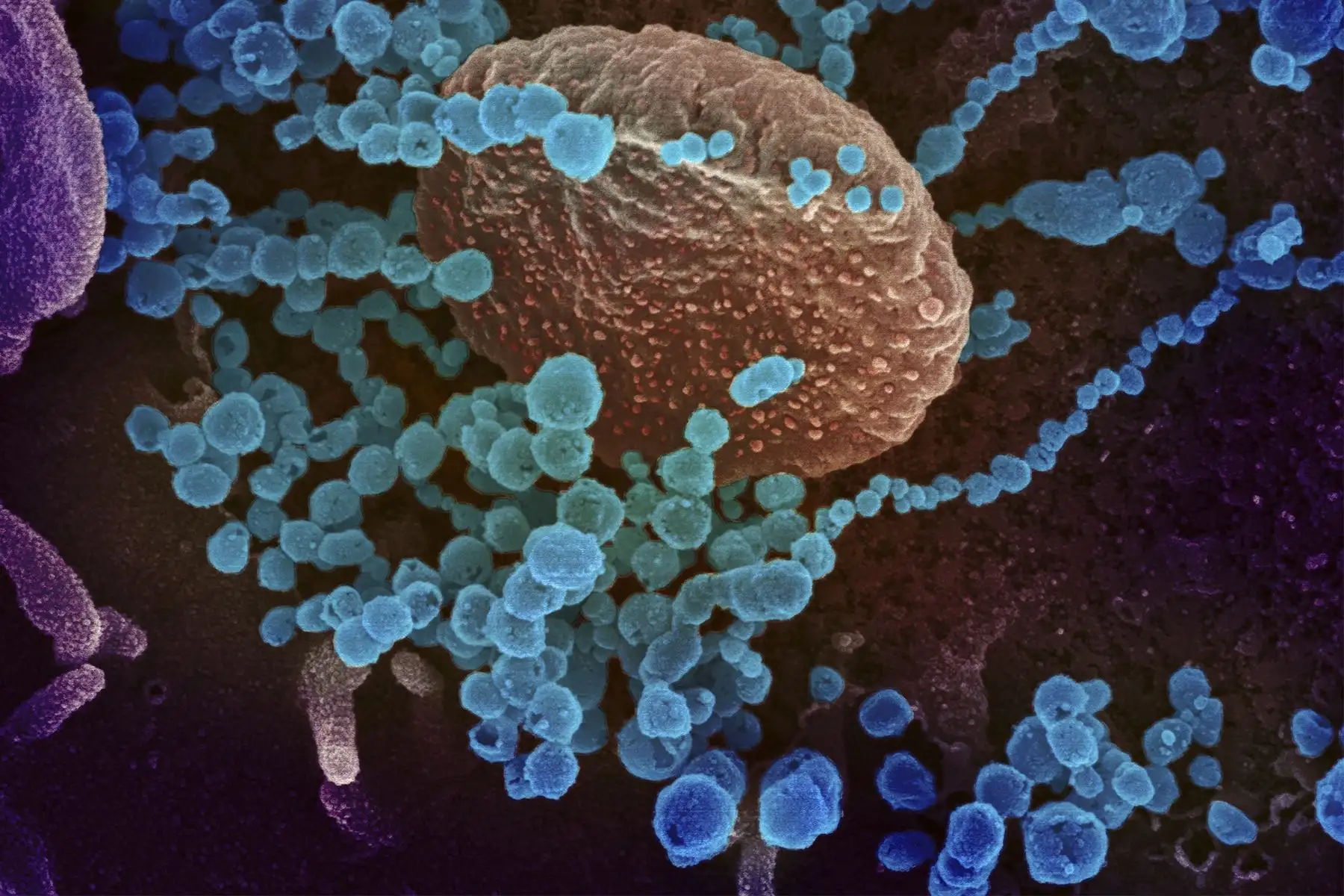 El equipo científico investigó el origen del covid-19 a partir del análisis comparativo de datos genómicos y determinó los posibles escenarios en los cuales pudo haber surgido. Foto: AFP/Instituto Nacional de Salud de Estados Unidos.