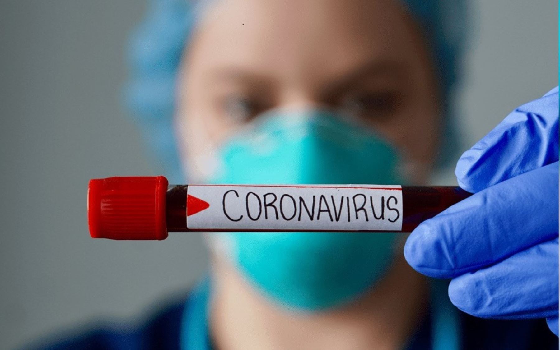 Coronavirus: reforzarán el control y vigilancia epidemiológica en ...