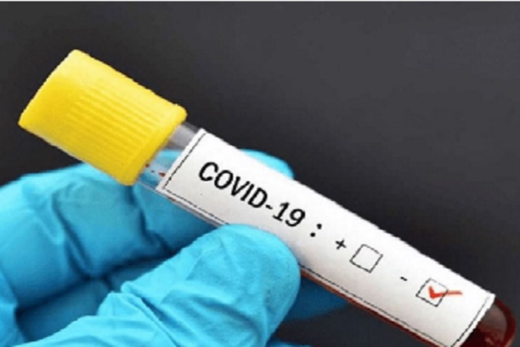 En la región Madre de Dios hay un solo caso confirmado de coronavirus (covid-19).