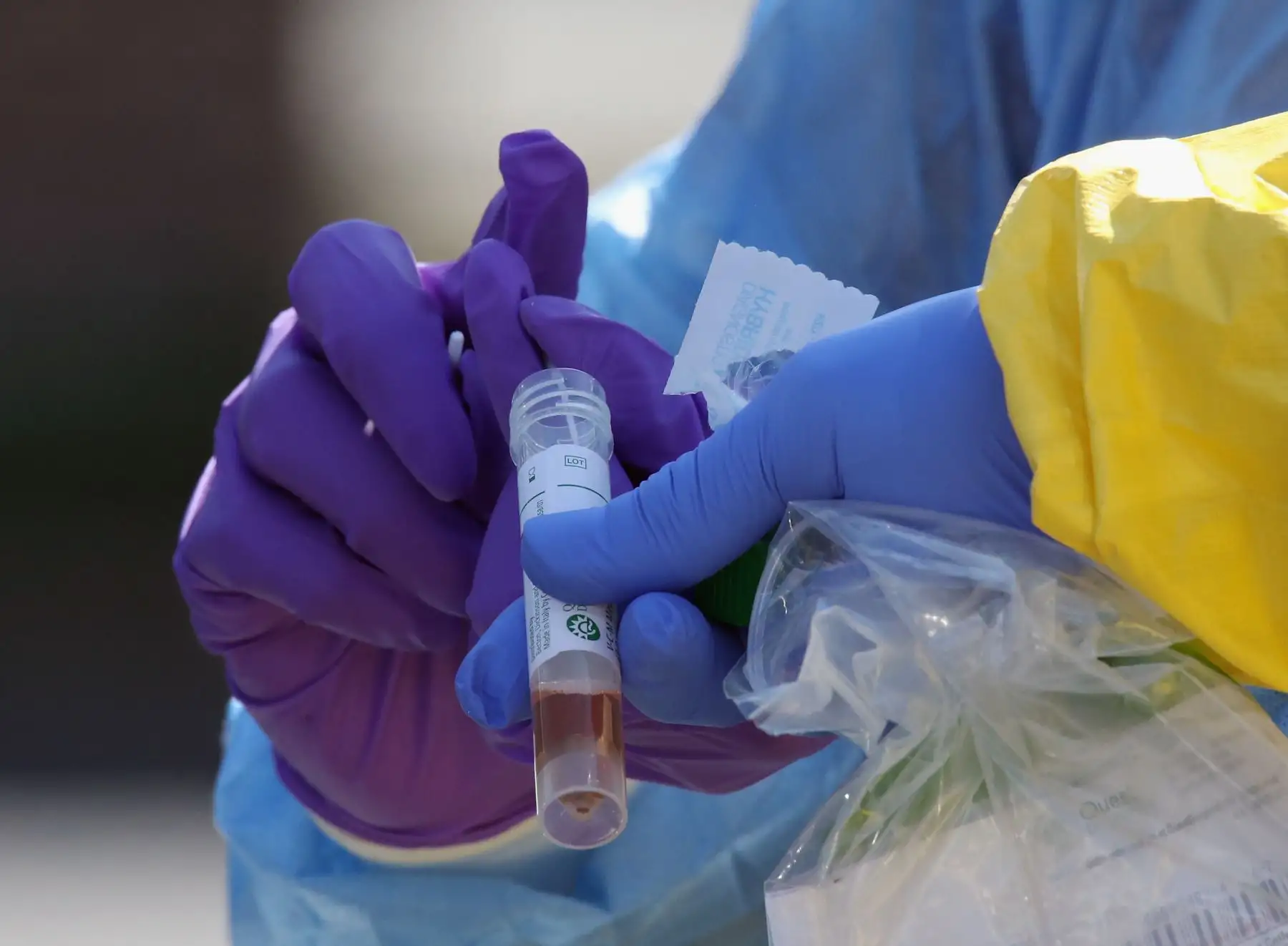 La región Lambayeque reporta su primer fallecido por coronavirus. Se trata de un adulto varón que fue internado en el Hospital Almanzor Aguinaga de EsSalud tras presentar un cuadro de insuficiencia respiratoria provocada por esta enfermedad.