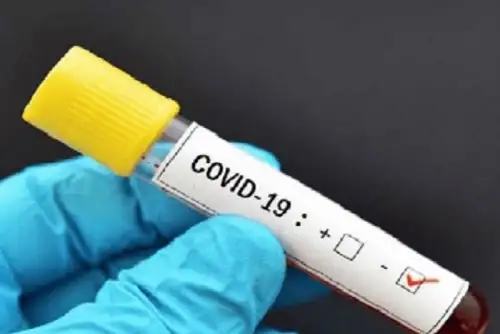 En las últimas 24 horas se registraron 880 nuevas infecciones. ANDINA/Difusión