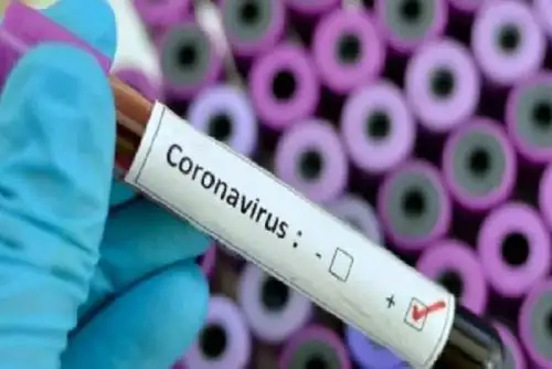 El número de personas infectadas con coronavirus en la región Loreto aumentó a 72,Foto:  informó hoy la Dirección Regional de Salud (Diresa) de Loreto. Esta cantidad representa un incremento de seis casos positivos respecto al reporte oficial de la víspera. ANDINA/Difusión