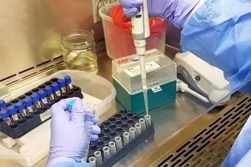 Intenso trabajo de laboratorio en el INS en Arequipa.
