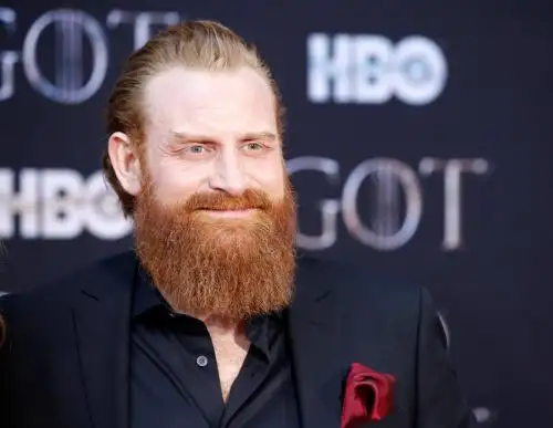 Kristofer Hivju, de "Game of Thrones" supera el coronavirus.