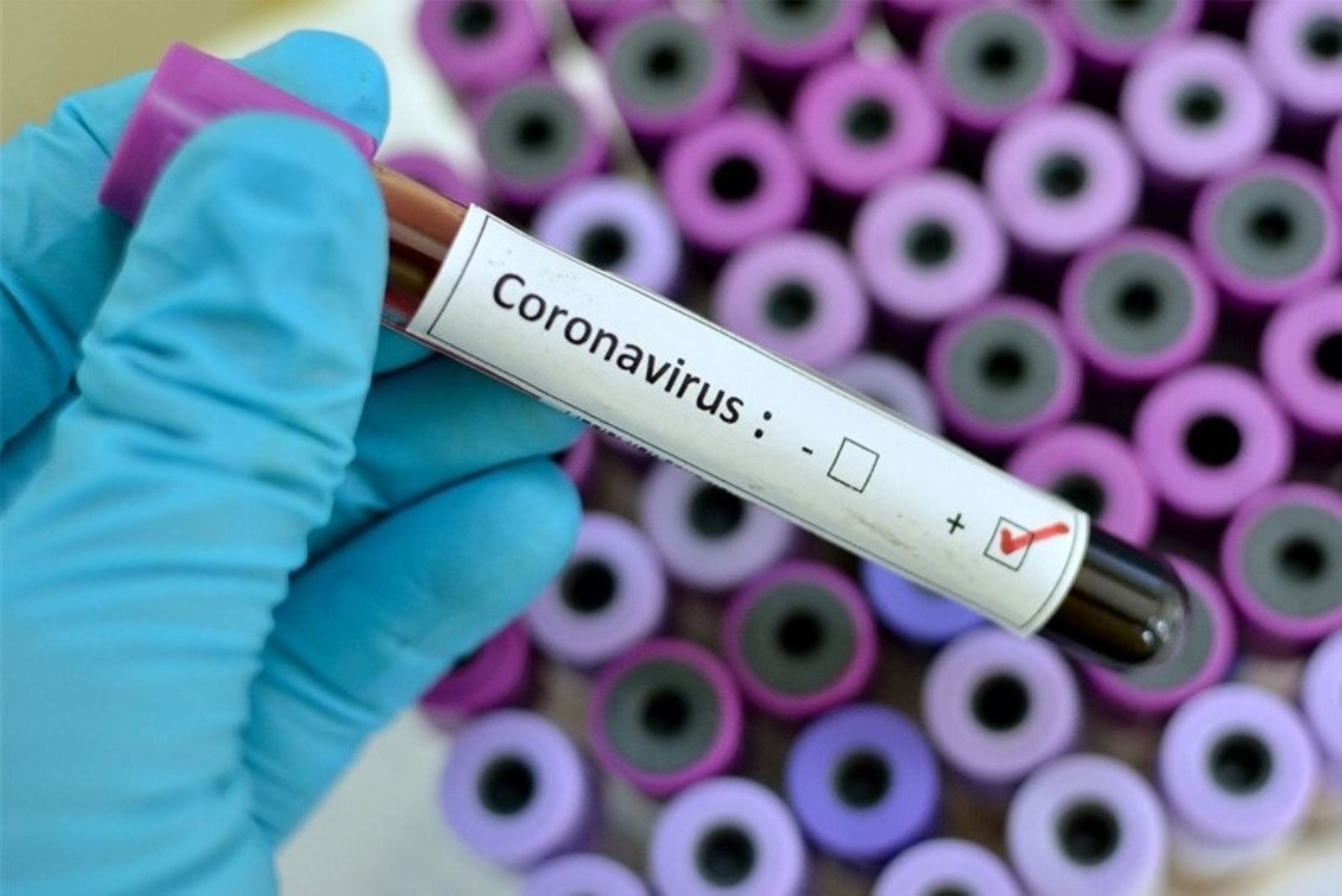 El Gobierno Regional de Lima instalará campamento para la atención de internos del penal de Cañete infectados con coronavirus. ANDINA/Difusión