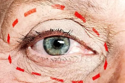 Coronavirus: brindan teleorientación gratuita sobre salud ocular. Foto: ANDINA/Difusión.