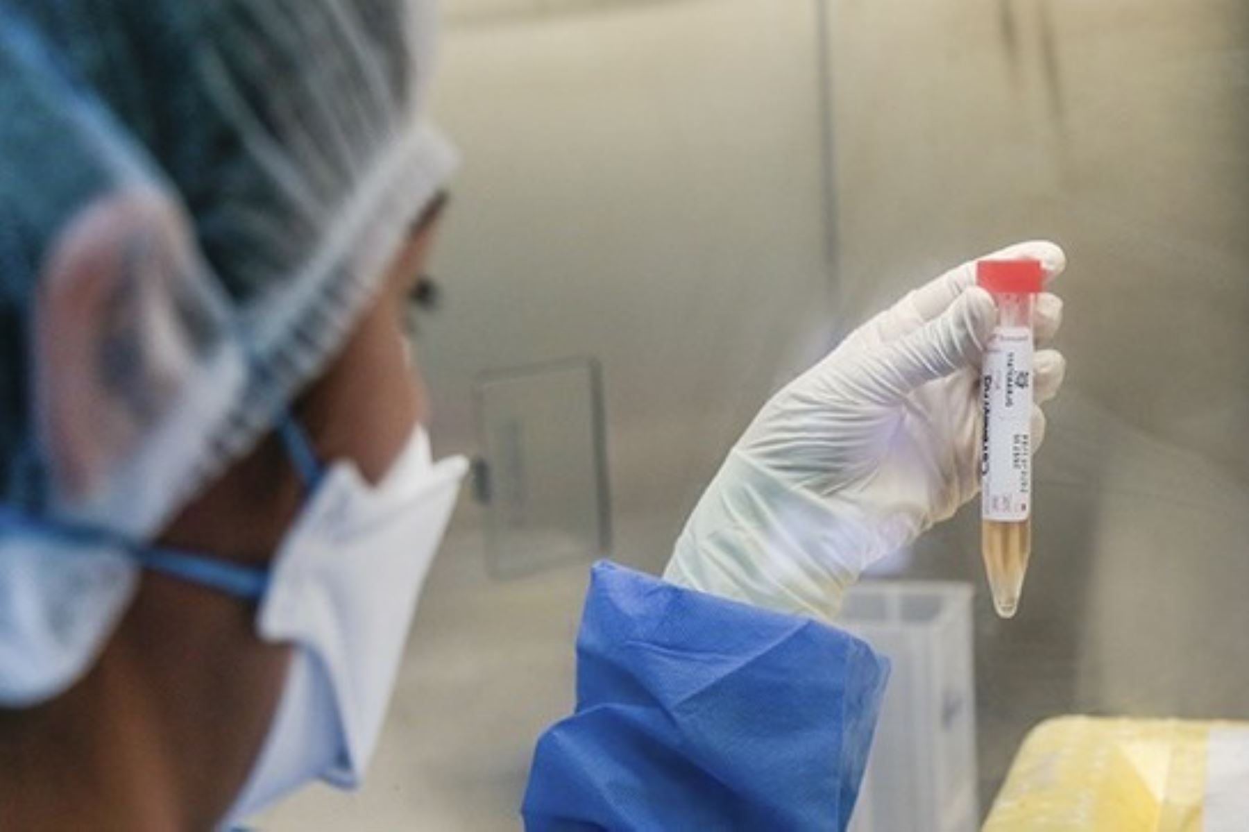 Coronavirus: INS crea prueba molecular para el diagnóstico en menos de una hora. Foto: ANDINA/Difusión.