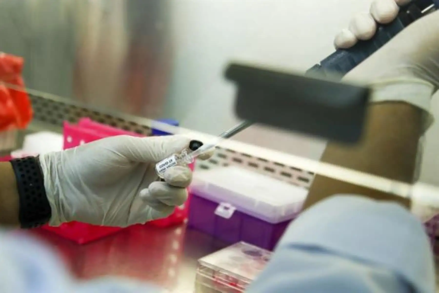 Los científicos detectaron un importante número de biomarcadores de proteína en el plasma cuya concentración en la sangre era mayor o menor según la gravedad de la enfermedad. Foto: EFE