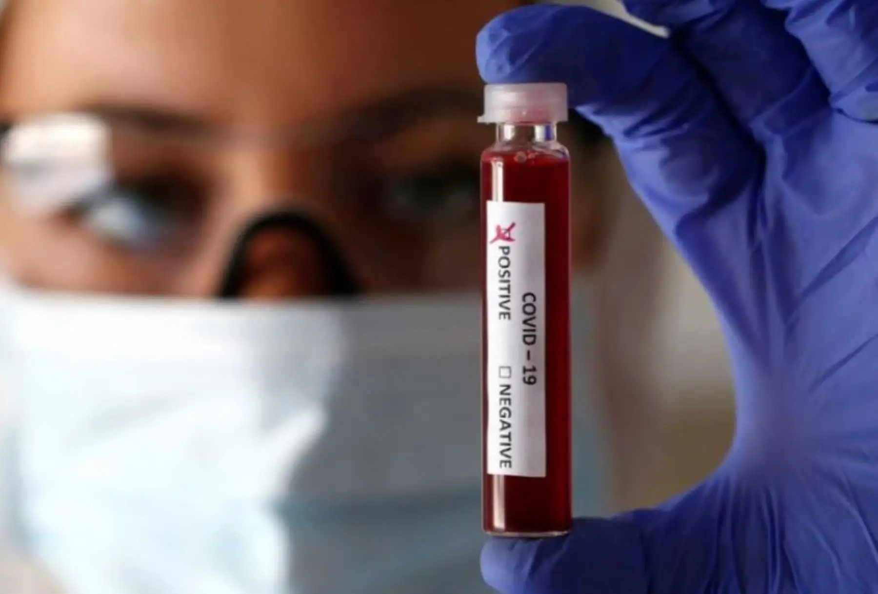 El ministro de Salud, Víctor Zamora dijo que el Perú quiere tener su propia prueba molecular para ampliar el uso de ella en todo el país y reducir progresivamente el tamizaje con prueba serológica (rápida).ANDINA/Difusión