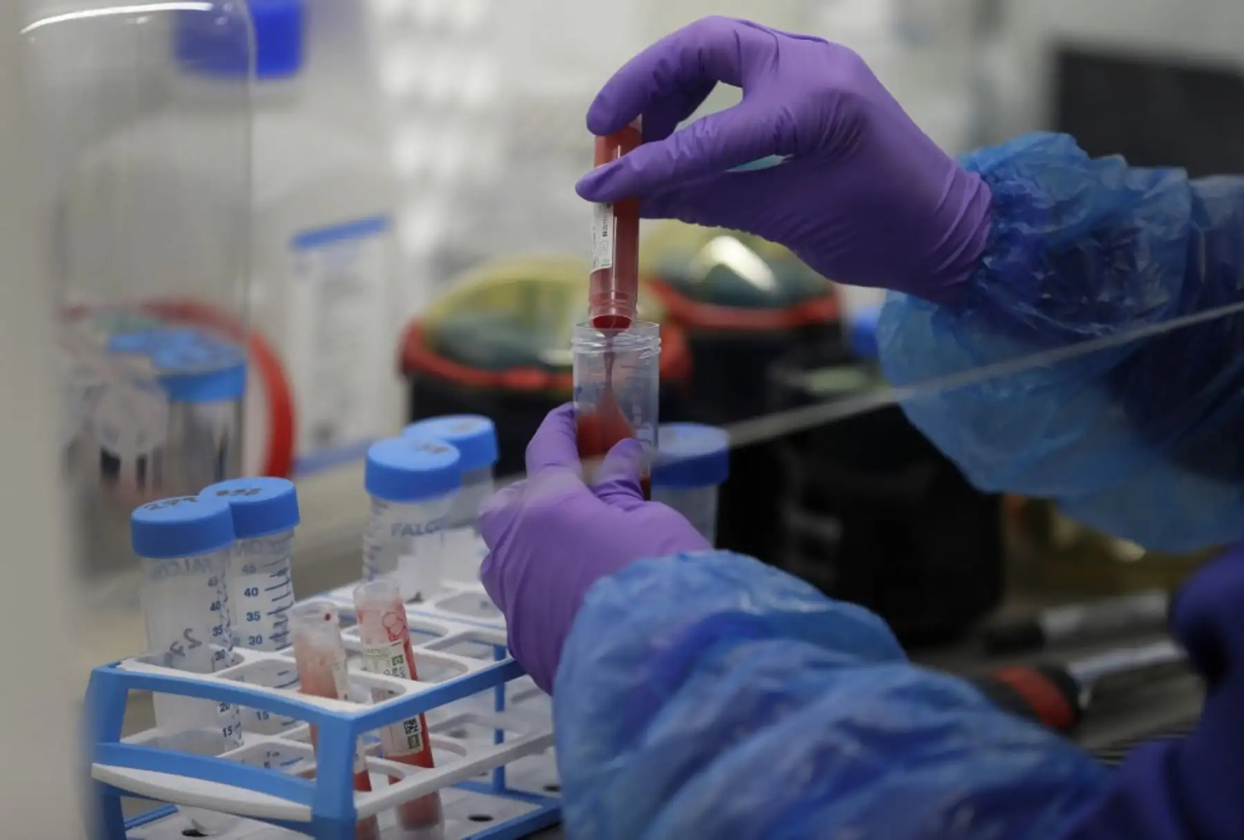 Las muestras de sangre de pacientes con coronavirus se preparan para el análisis como parte del ensayo TACTIC-R, en el Laboratorio de procesamiento de sangre en el Instituto de Inmunología Terapéutica y Enfermedades Infecciosas de Cambridge, en Cambridge, Inglaterra. Foto: AFP