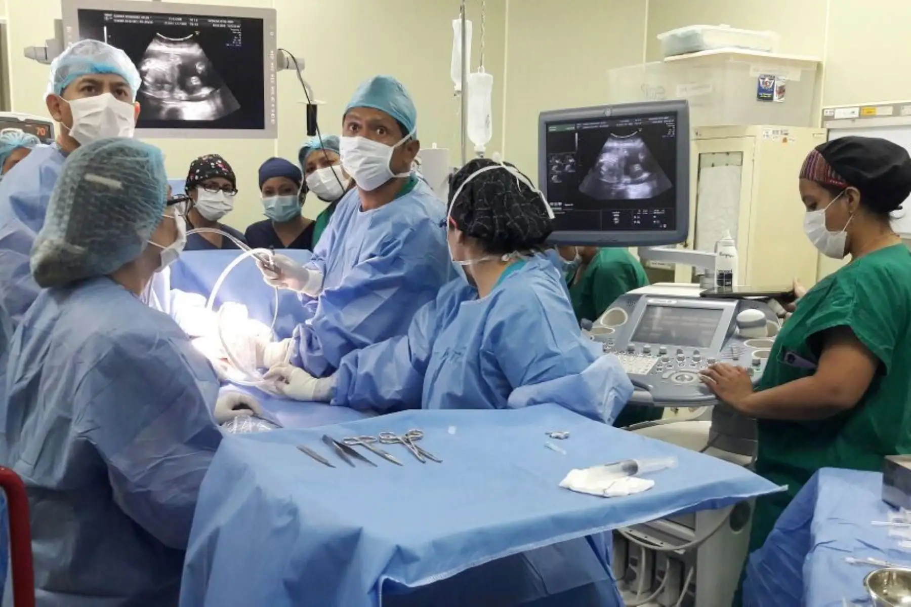La vida no se detiene. Un equipo de especialistas del Instituto Materno Perinatal salvaron la vida de cinco bebés víctimas del Síndrome de Transfusión Feto Fetal.  ANDINA/INMPN