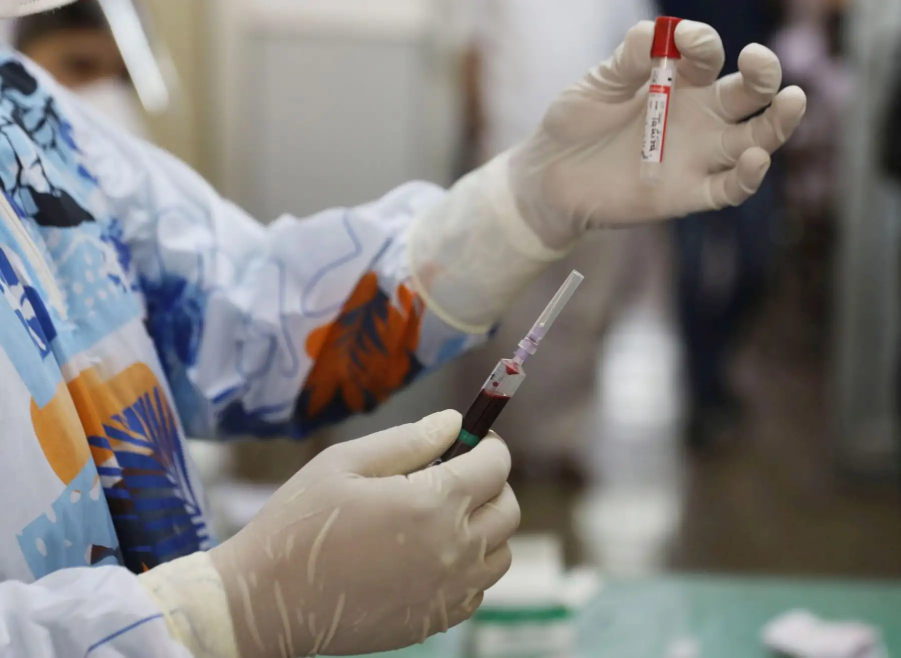 El nivel de anticuerpos de la gran mayoría de las personas infectadas mostró una disminución significativa dos o tres meses después de la infección. Foto: EFE