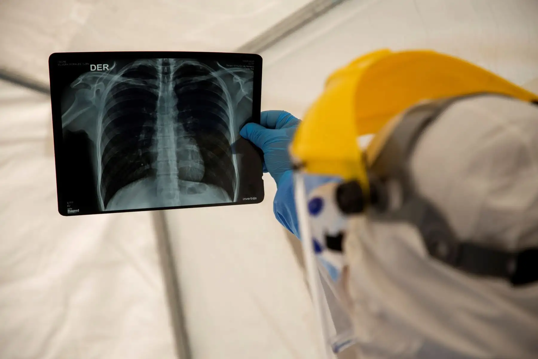 Ecuador registró en 2018 un promedio de 23 médicos y 15 enfermeras por cada 10,000 habitantes, según los datos oficiales más recientes. Foto: EFE/Archivo