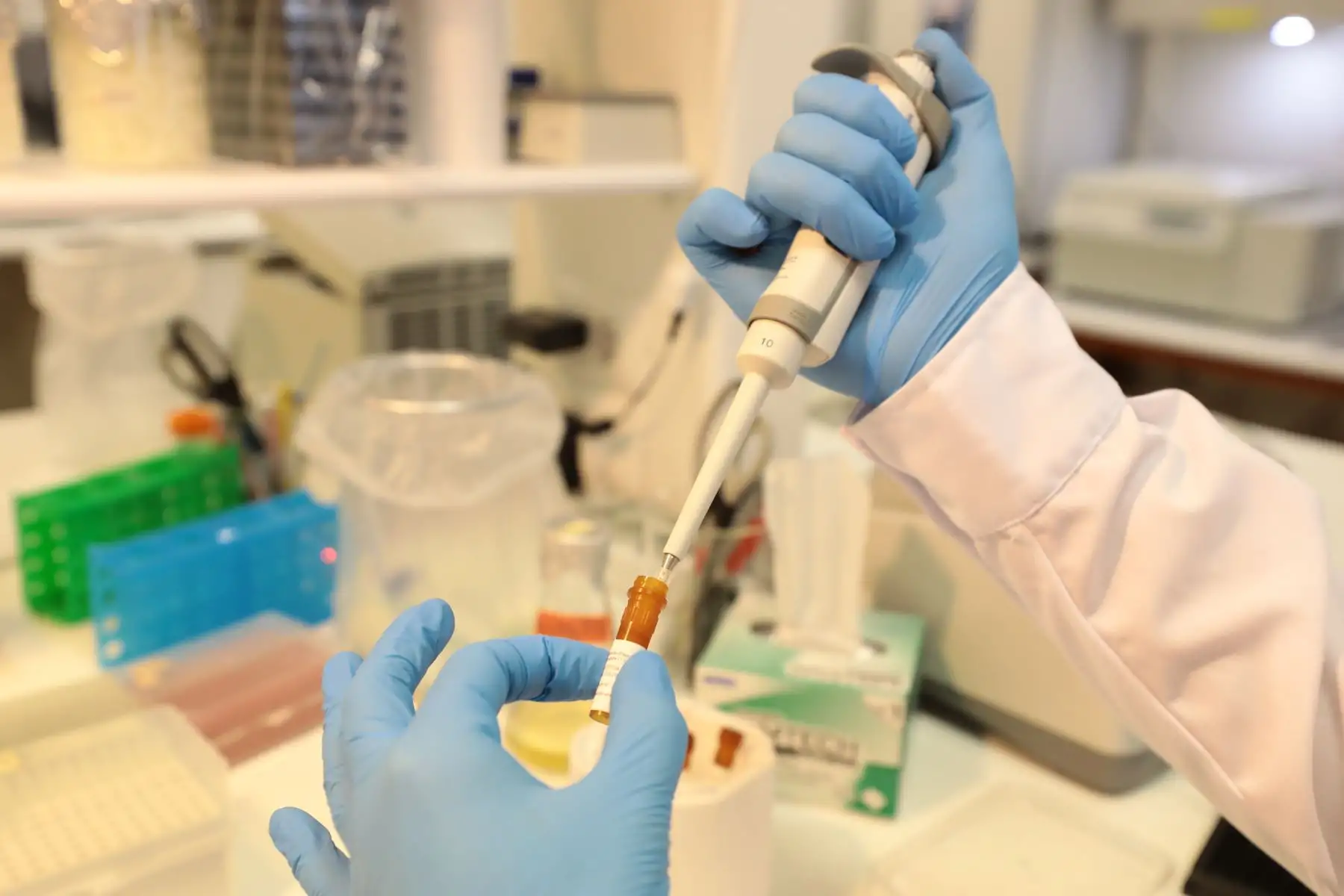 Essalud promoverá investigación con Universidad Cayetano Heredia para elaborar pruebas moleculares para detectar Covid-19 con resultados en 40 minutos. Foto: ANDINA/Essalud