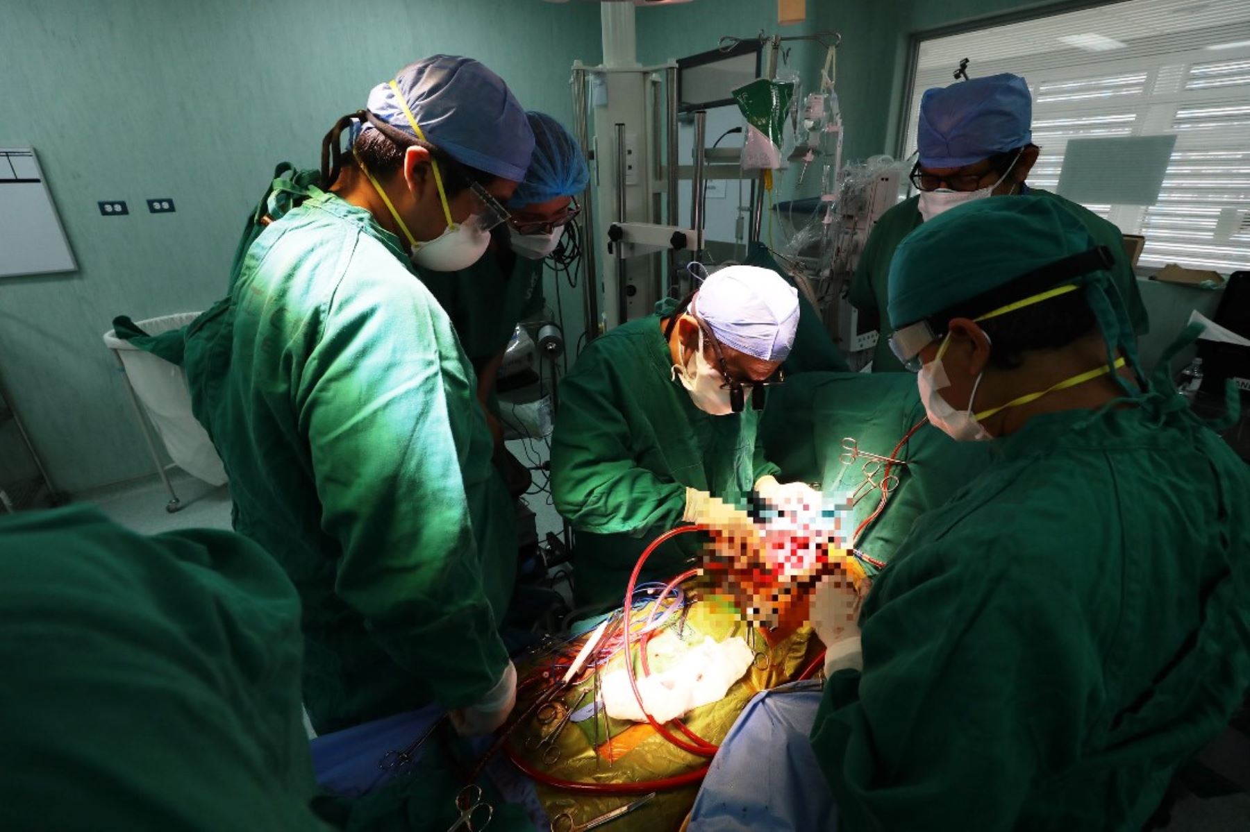 EsSalud realiza exitosa cirugía para curar rara enfermedad del corazón. Foto: ANDINA/difusión.