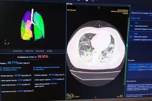 El conjunto de datos utilizado para el entrenamiento al algoritmo IA reúne información de casos a nivel mundial.