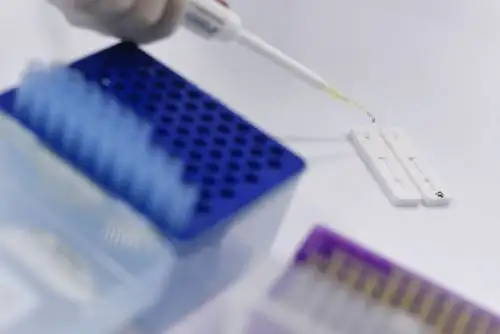 Brasil es el segundo país más afectado por el coronavirus, detrás de Estados Unidos. Foto: AFP